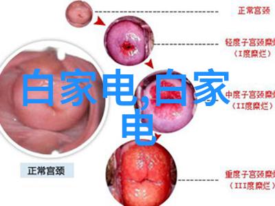 我可以通过哪些方法来保护我的拍照手机免受损坏或破坏