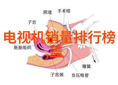 液力耦合器-液力耦合器原理与应用概述