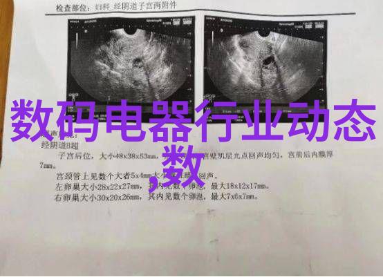 重铸时空45厚壁钢管的沉默叹息